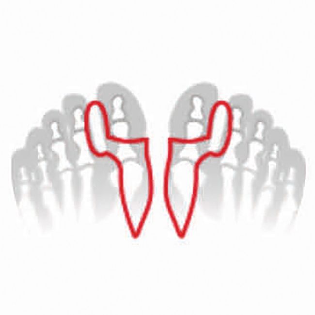 babybutt FußGut Hallux-Korrektor 1 Paar Zeitlich begrenztes Angebot